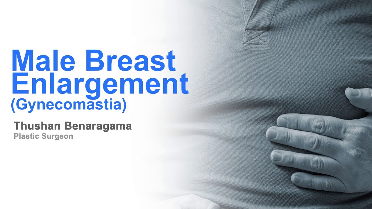 Male breast enlargement issue (gynecomastia) and Treatments.