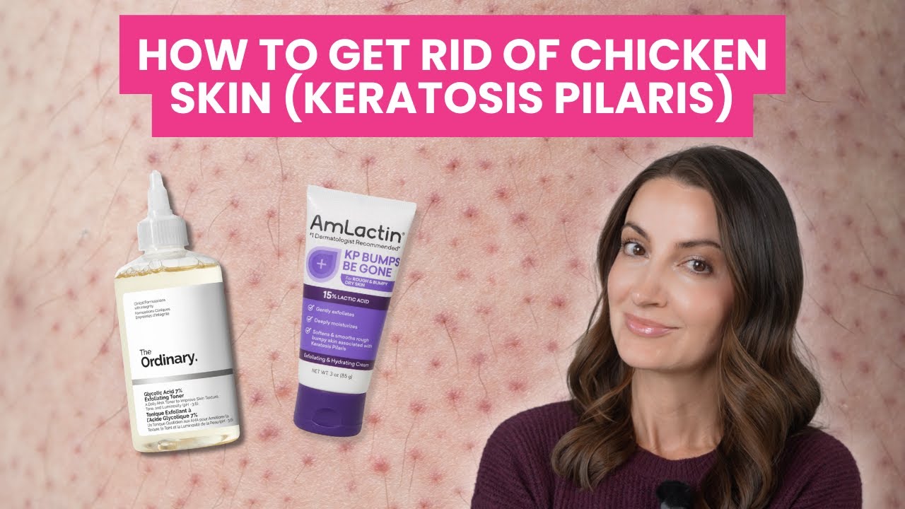 How to Get Rid of Keratosis Pilaris (KP) | Chicken Skin Causes & Treatments Explained