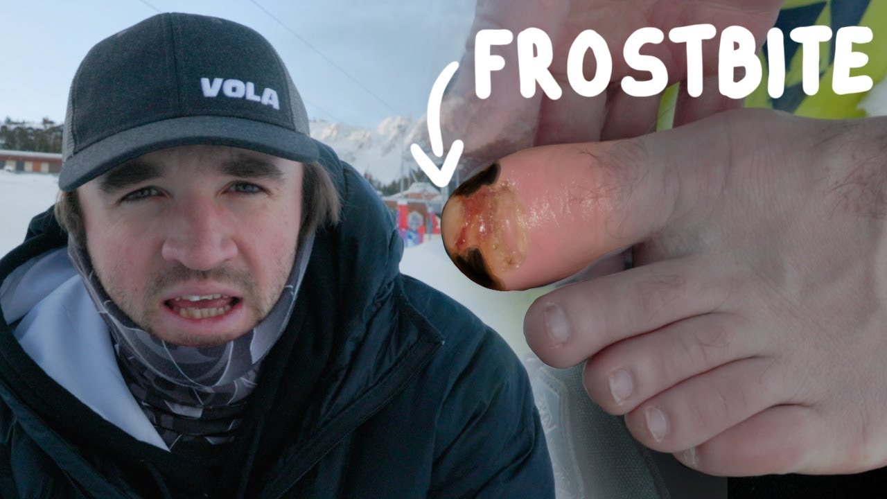 I Got Frostbite in Austria… And Still Had to Train