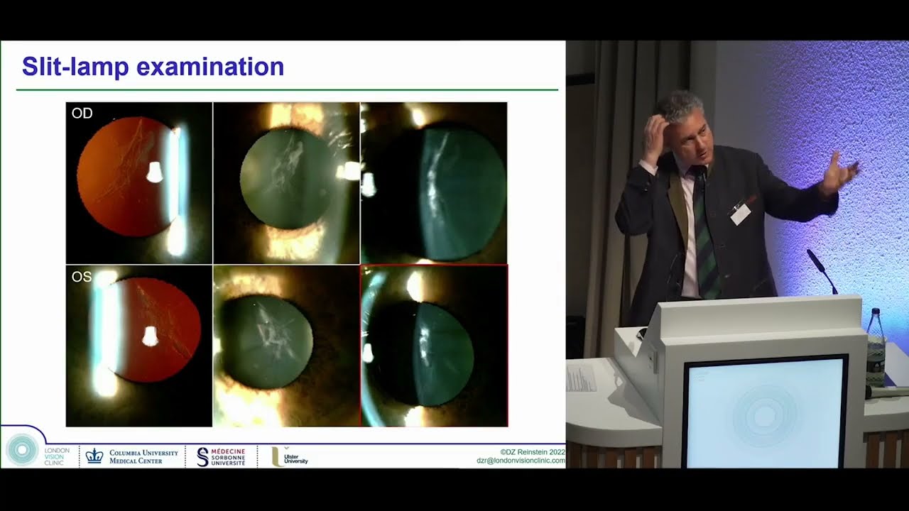 Forefront Refractive Surgery Course, Day 2, Lecture 7: Cataract and LASIK PRESBYOND