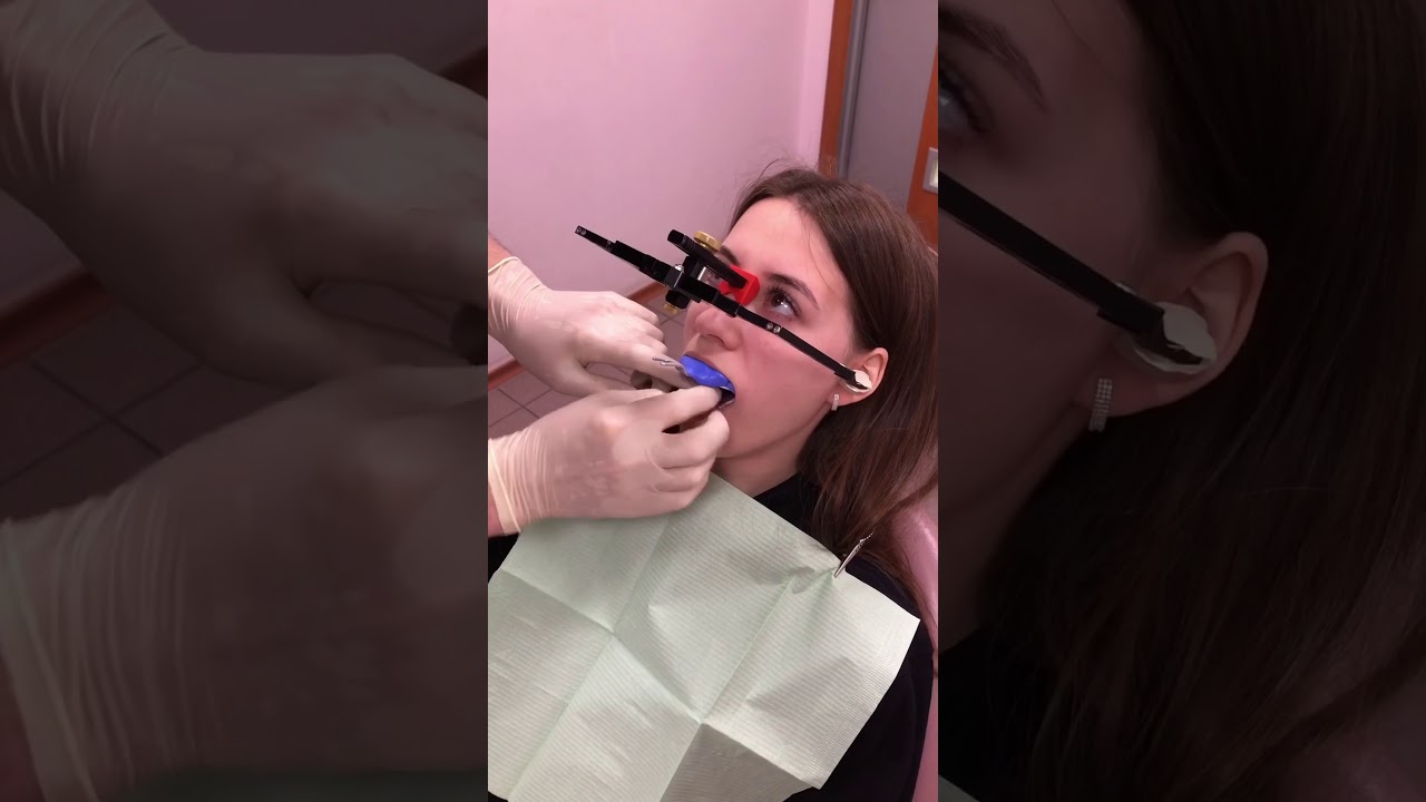 Применение лицевой дуги Reference AB