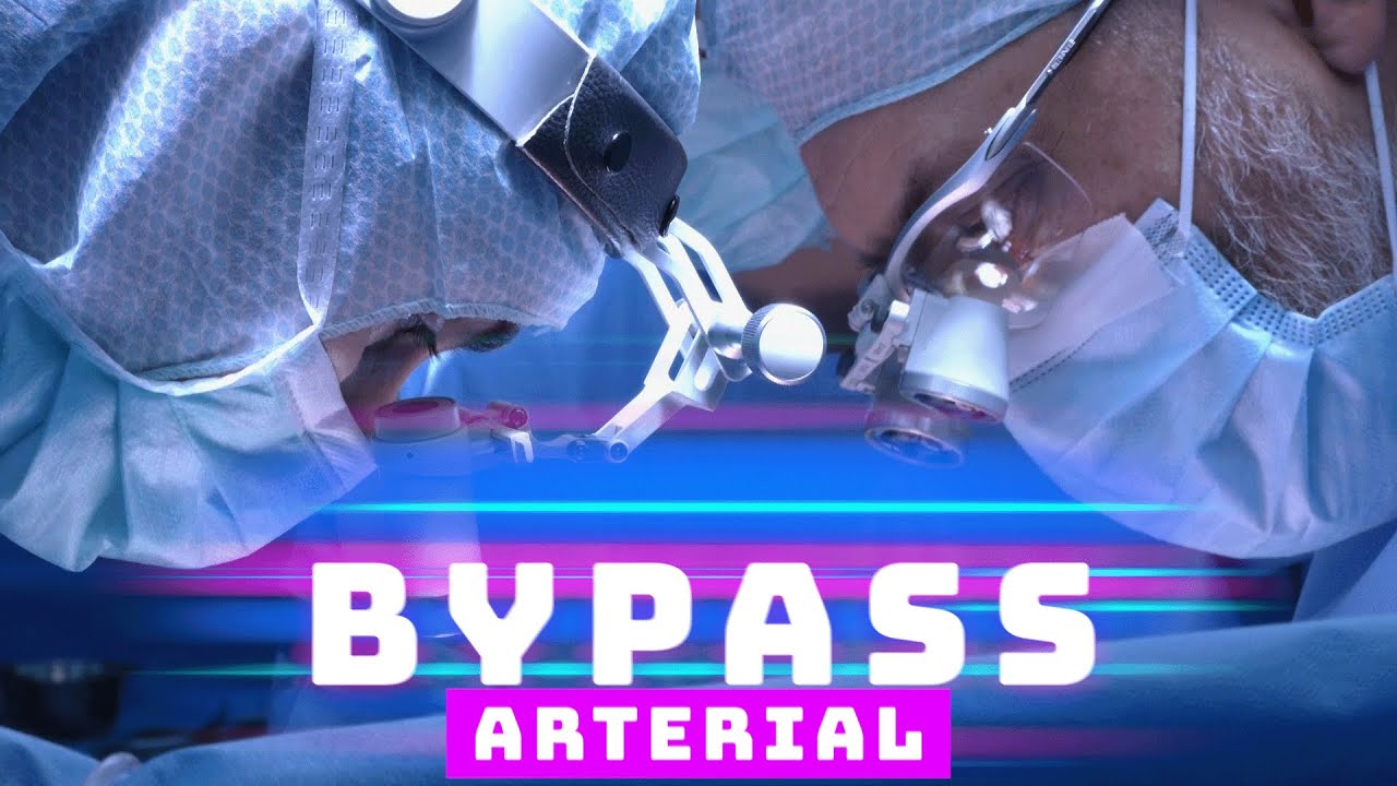 BYPASS ARTERIAL