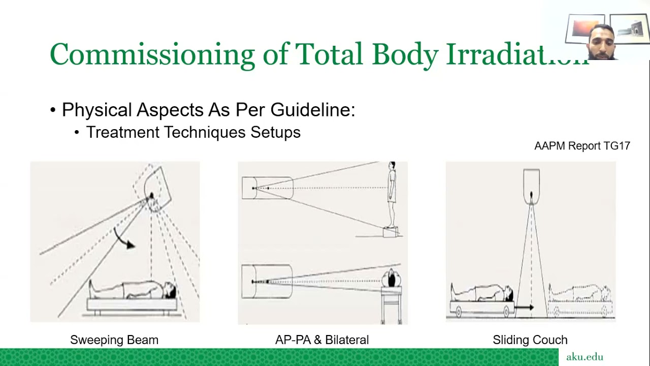 Total Body Irradiation AKUH experience