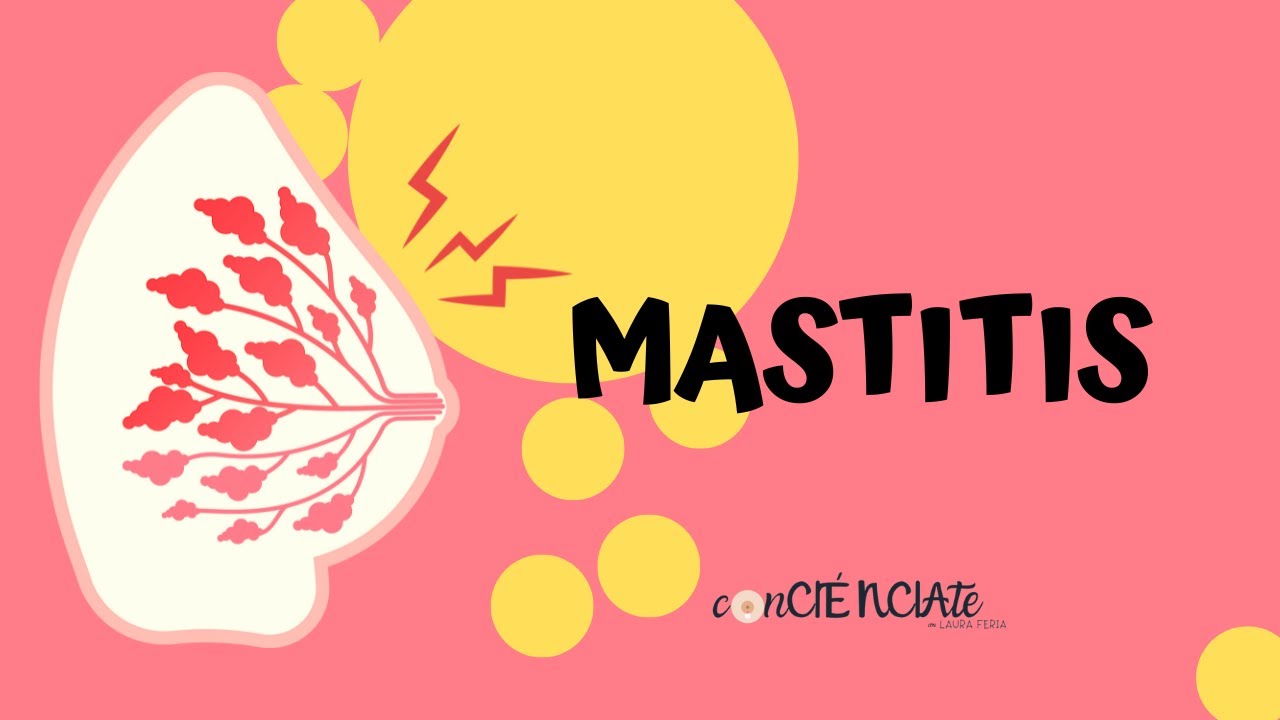 MASTITIS