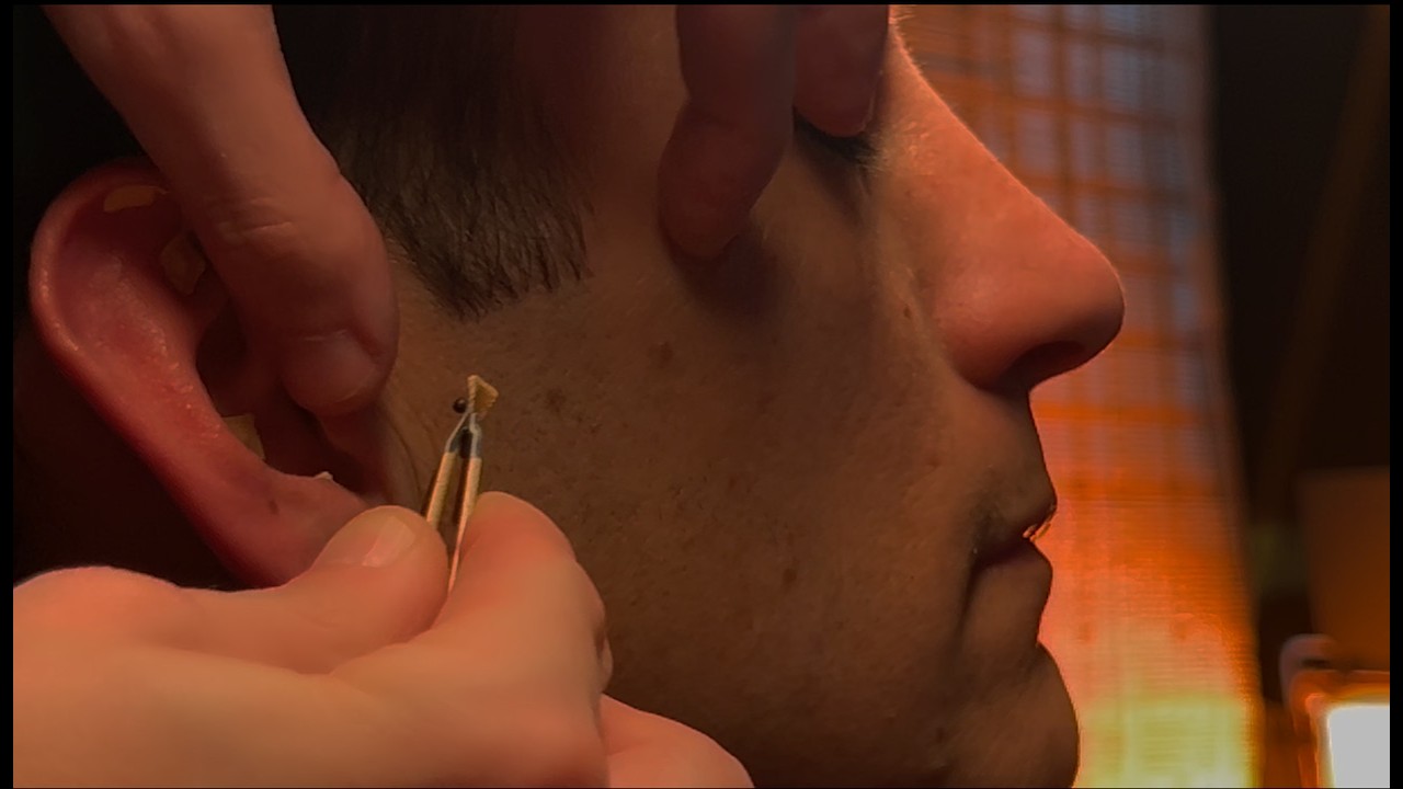 Ear Seeding + Acupressure - The 10 “Master” Auricular Points⚡️ [Real Person ASMR] ft.Tom 👂🧡
