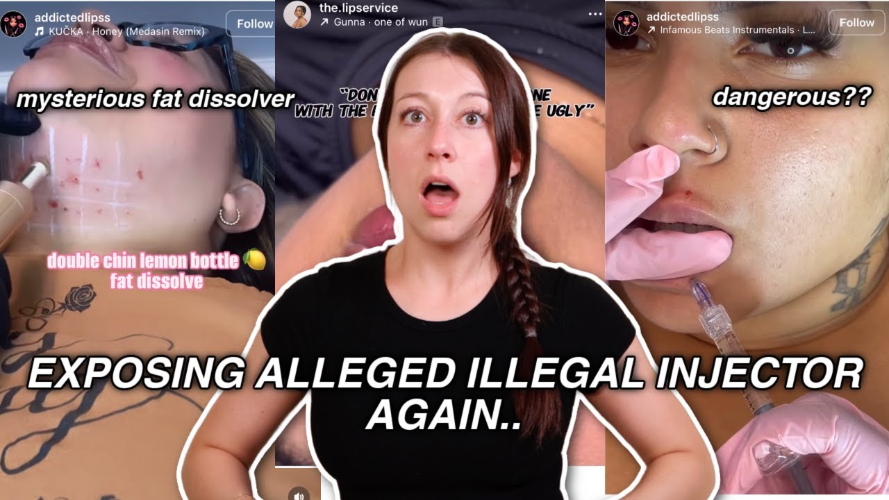 Exposing Alleged Illegal Injectors...AGAIN! *Full body injections*