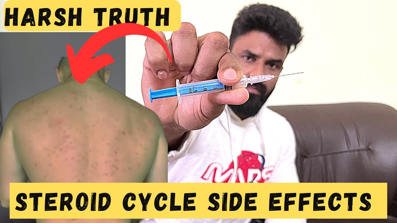 Side effects am facing in steroid cycle | Tamil