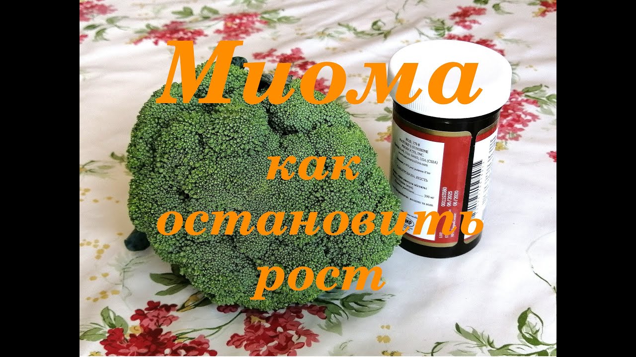 🇺🇦 МИОМА. КАК Я ОСТАНОВИЛА РОСТ.