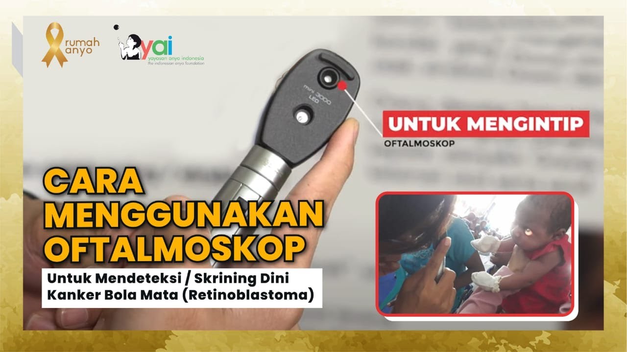 CARA MENGGUNAKAN OFTALMOSKOP (How to use ophthalmoscope)