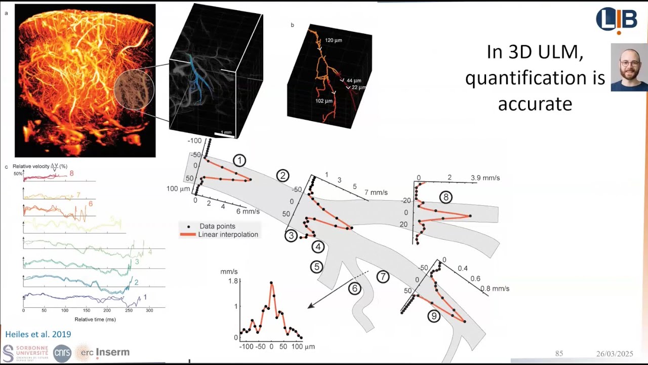 Volumetric ultrasound localization microscopy - Olivier Couture - Shape seminar