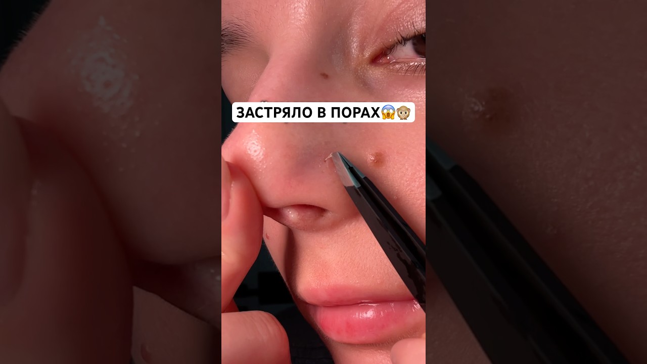 Конда постоянно что-то в порах🤢🙊Арт. энзимной пудры #WW304542 (копируй арт. с буквами) РП