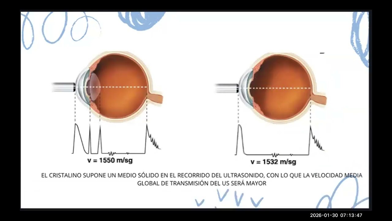 Biometria y Calculo de LIO