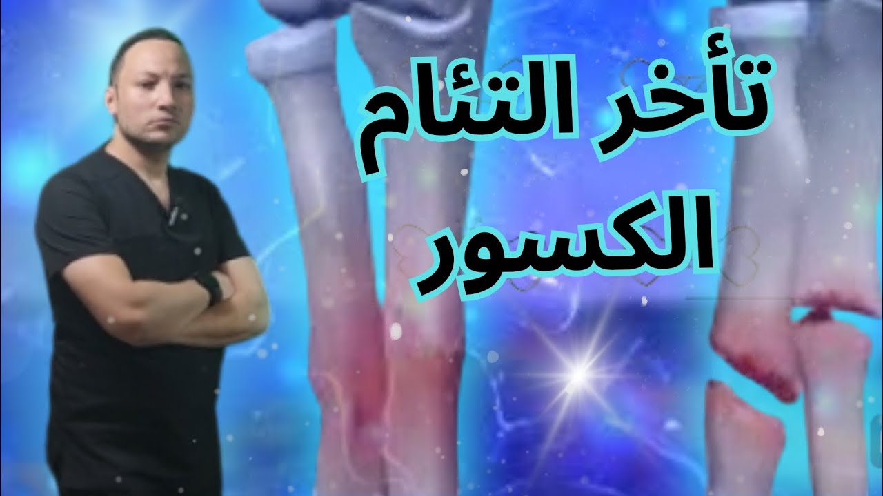التئام كسور العظام_أسباب عدم التئام العظام و تأخر الالتئام وعلاجه