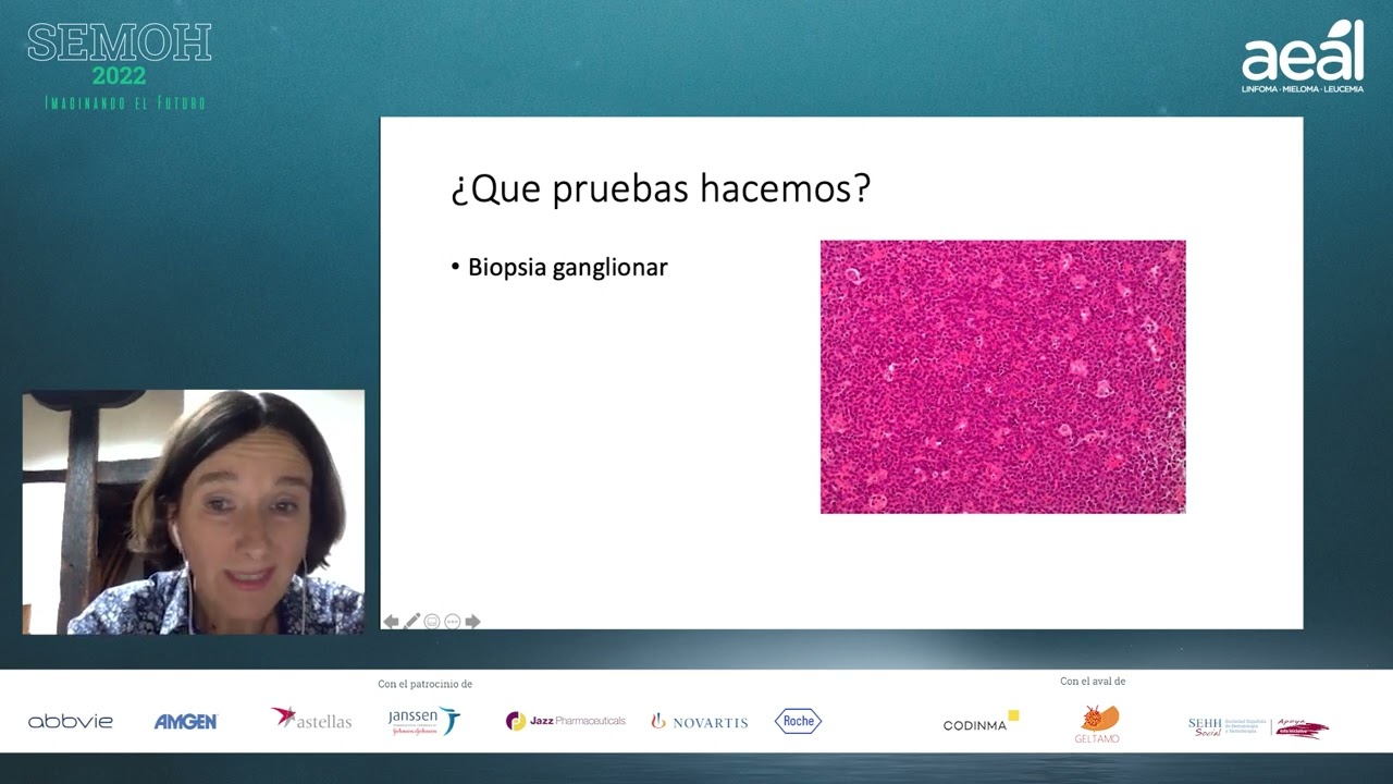 Linfoma b difuso de células grandes