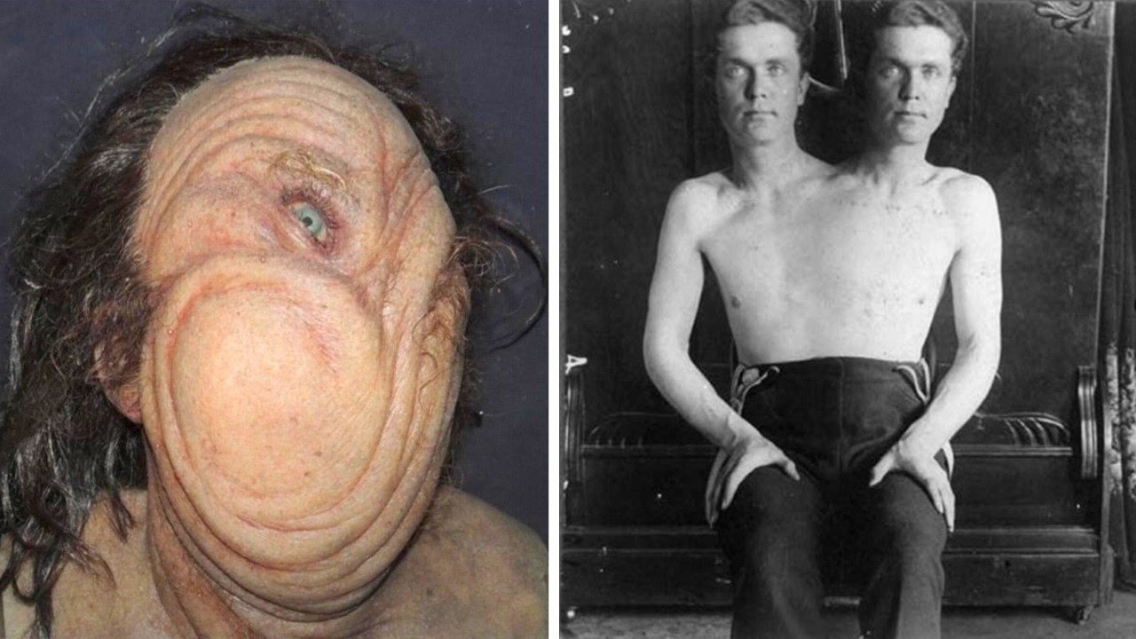 ¡15 Fenómenos de Circo Impactantes Que Realmente Vivieron!