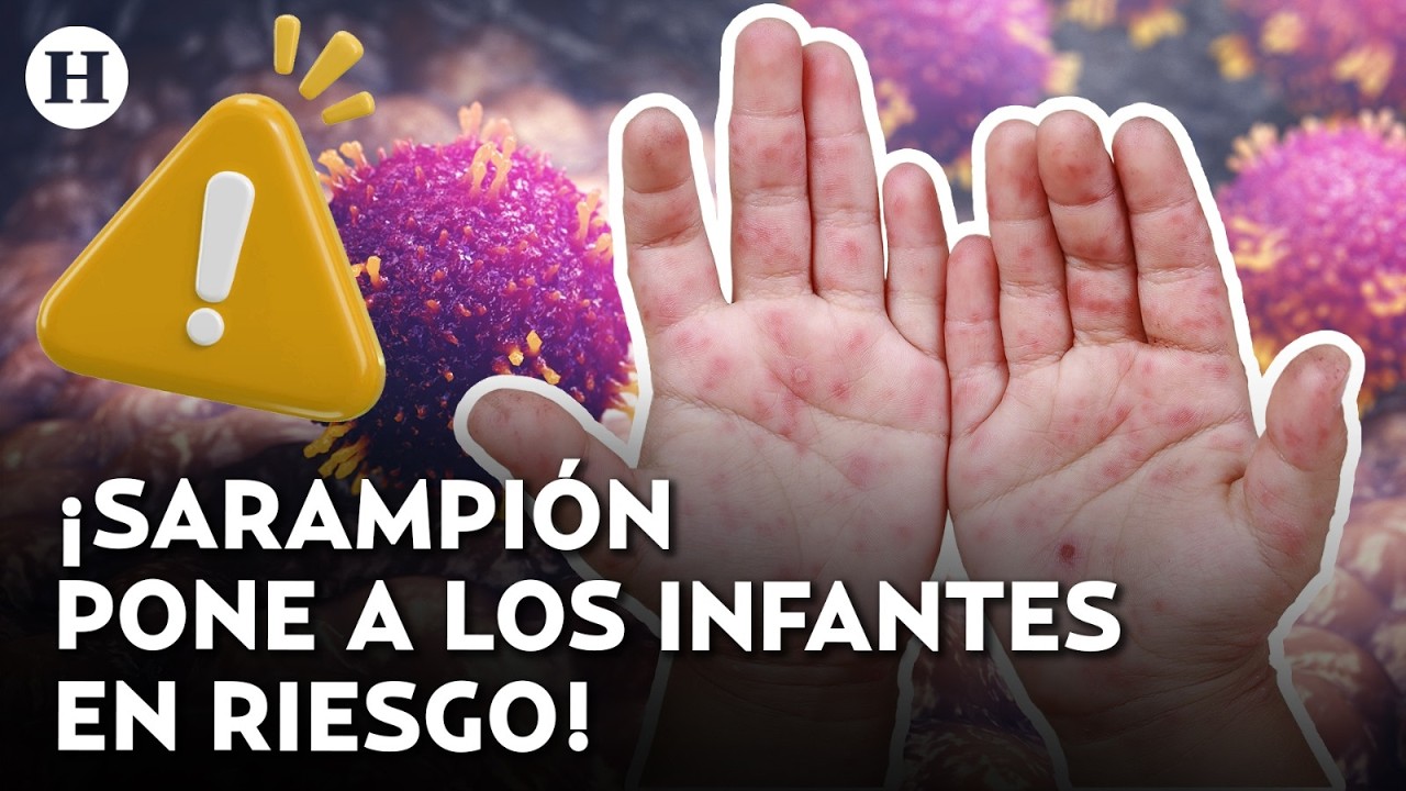 &iquest;Debo vacunar a mis hijos contra el sarampi&oacute;n? Ni&ntilde;os son los m&aacute;s vulnerables, seg&uacute;n el ISSSTE
