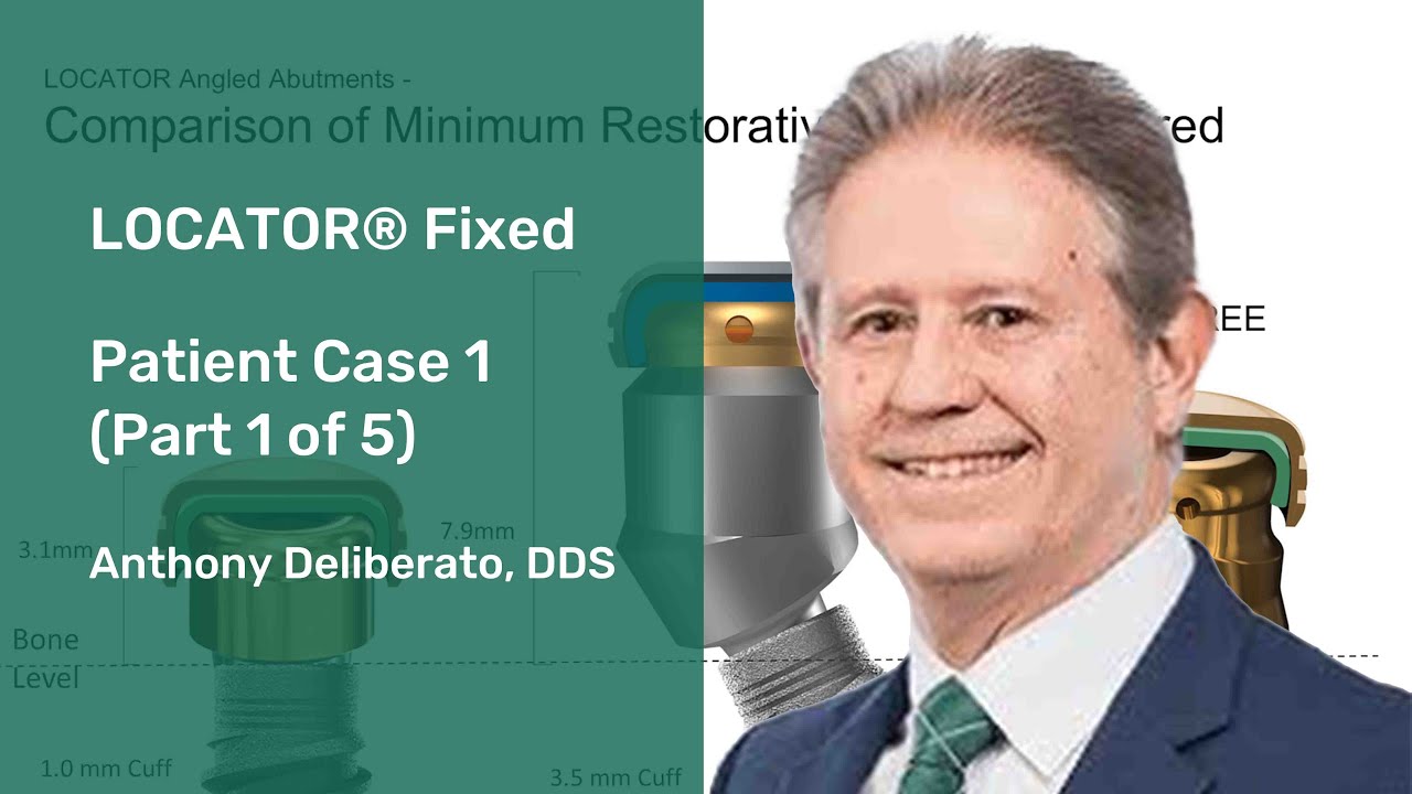 LOCATOR® Fixed: Patient Case 1 Part (1 of 5)