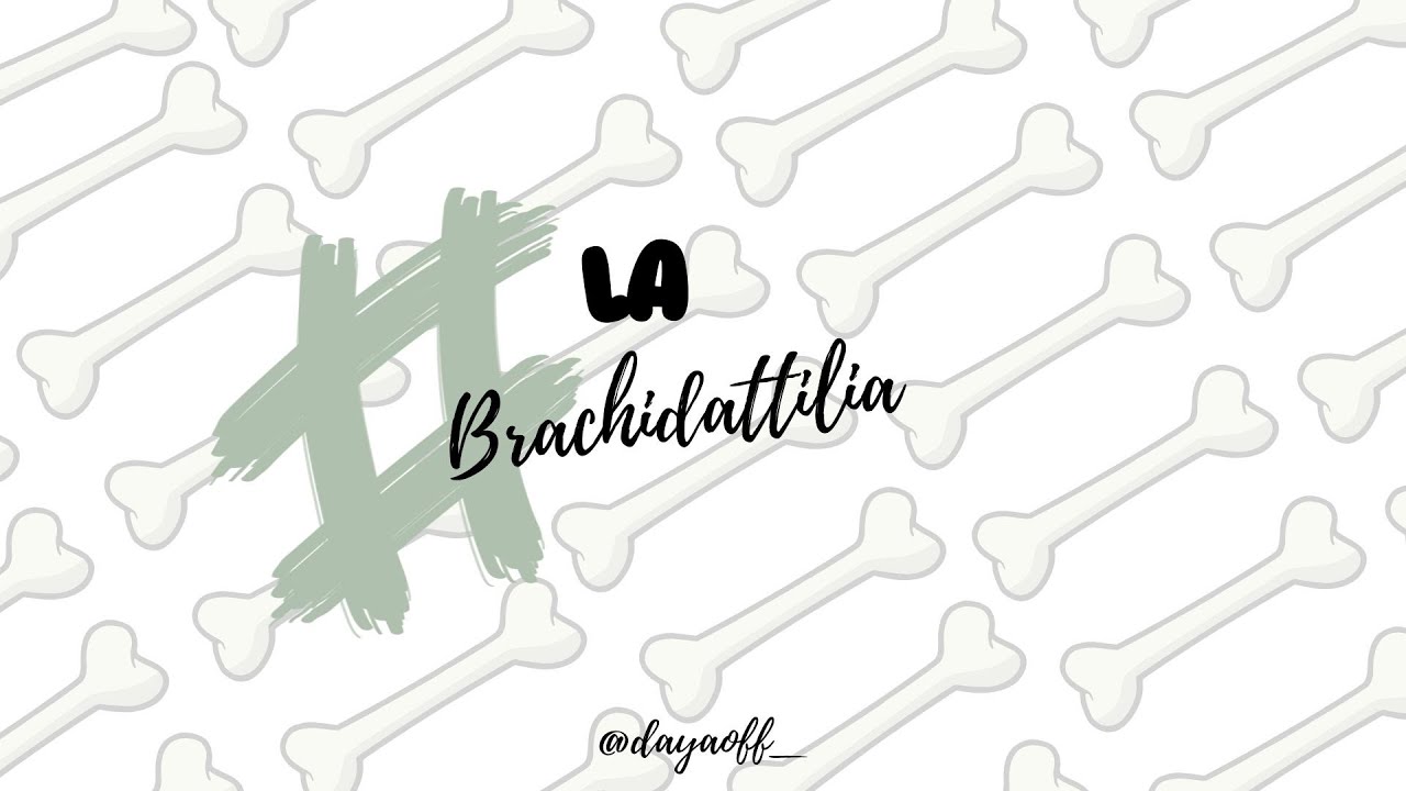 Dita Corte? Parliamo della Brachidattilia Senza Tab&ugrave; (in pillole)