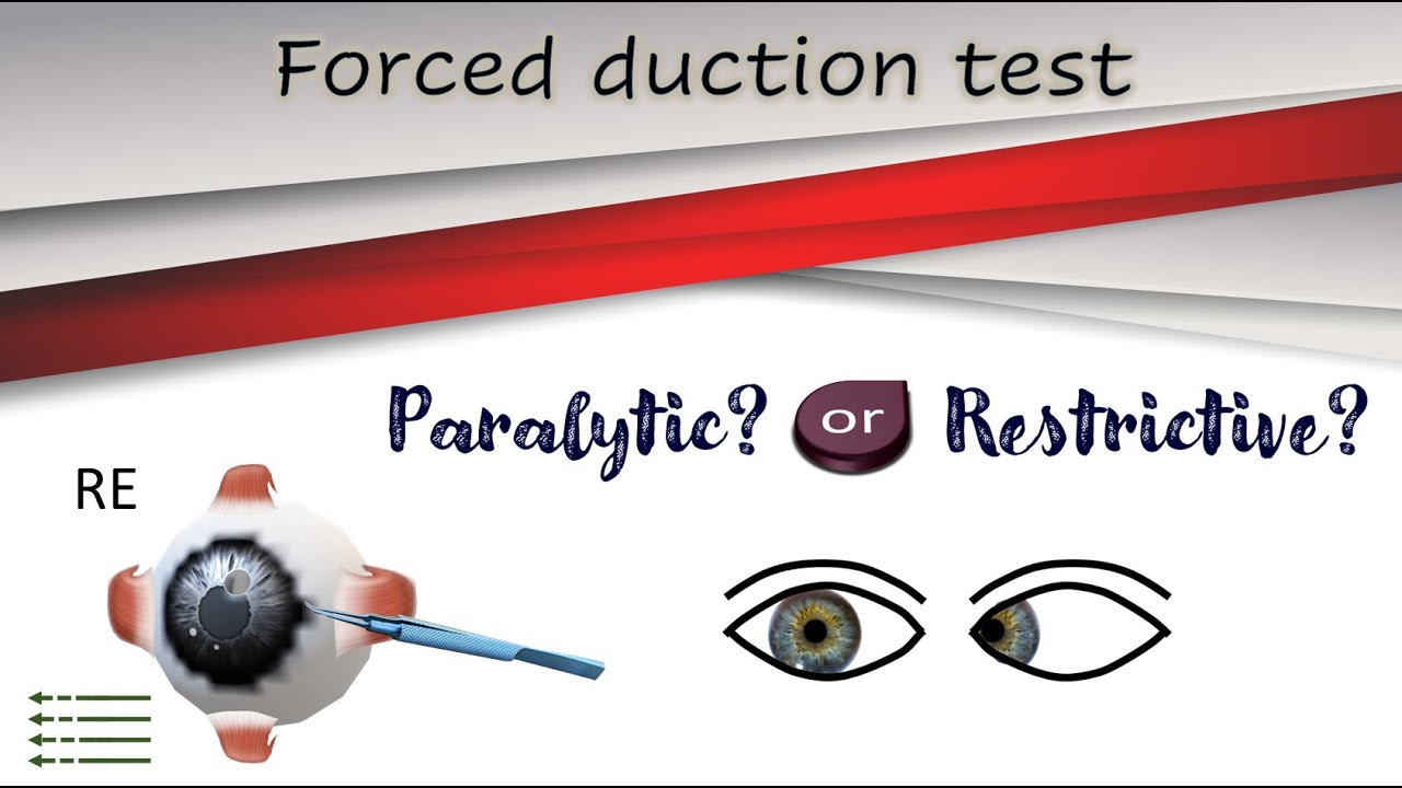 Forced duction test │Active force generation test