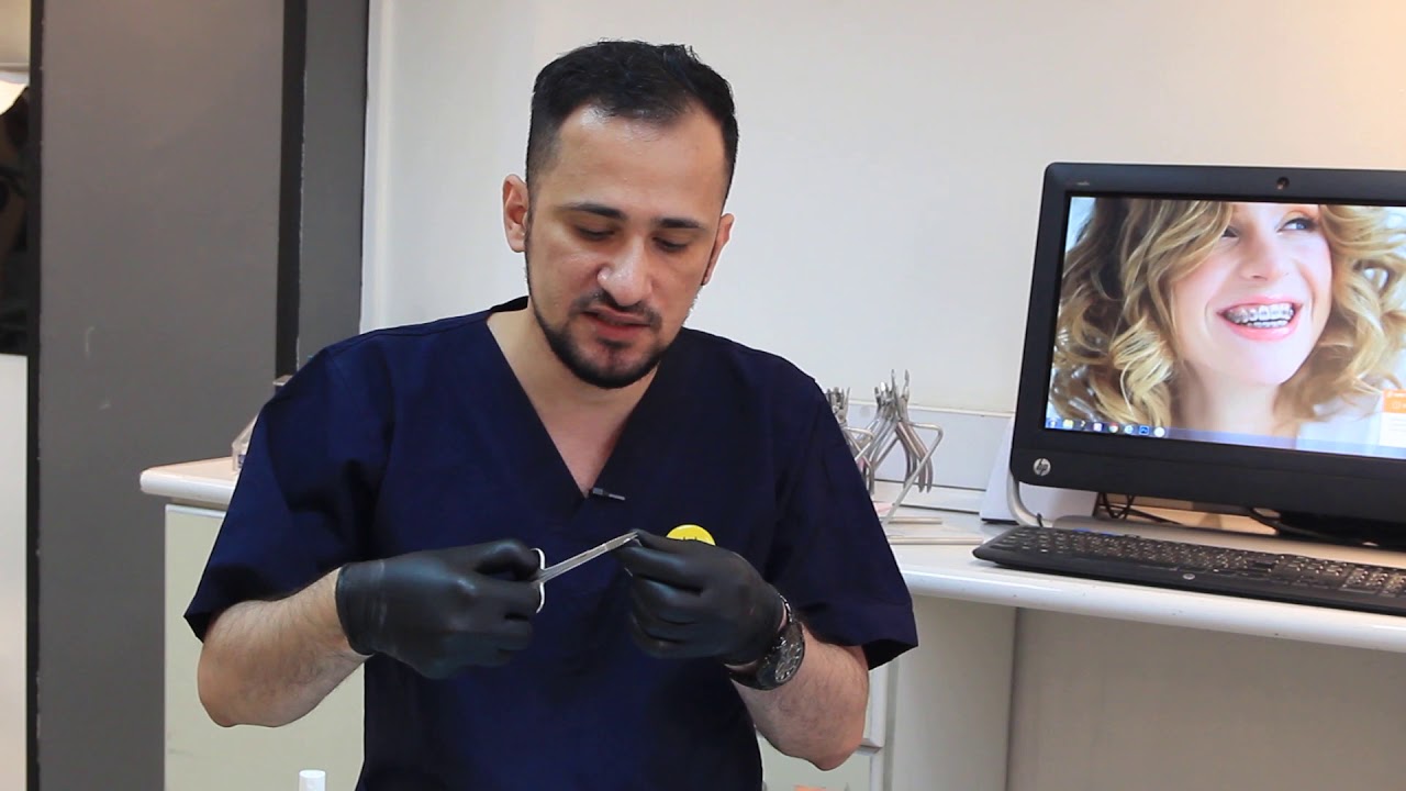 تنظيف تقويم الاسنان مع الدكتور منتصر الكيلاني .ابتسامة بغداد