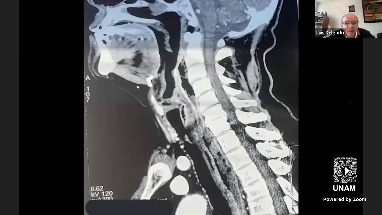 Repaso Zoom Anatomía del Cuello.