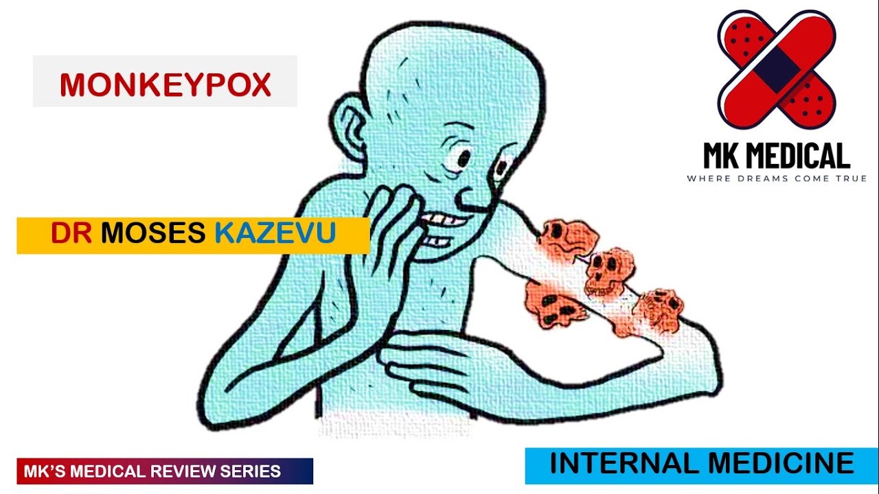 Monkey Pox