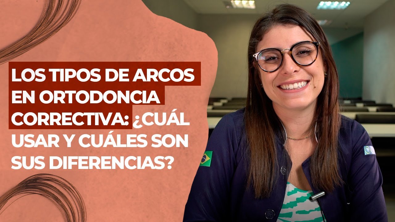 Los tipos de Arcos en Ortodoncia Correctiva: ¿Cuál usar y cuáles son sus diferencias?