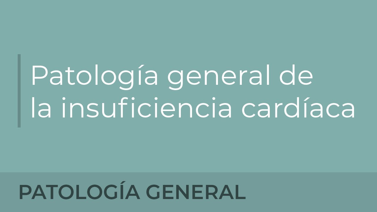 Patología general de la insuficiencia cardiaca. Miguel Barranco Gutiérrez