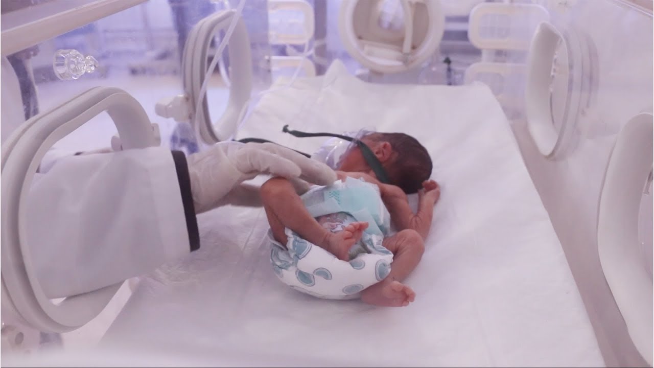 طفلة تنجو من الموت بعد ولادتها في الشهر السادس