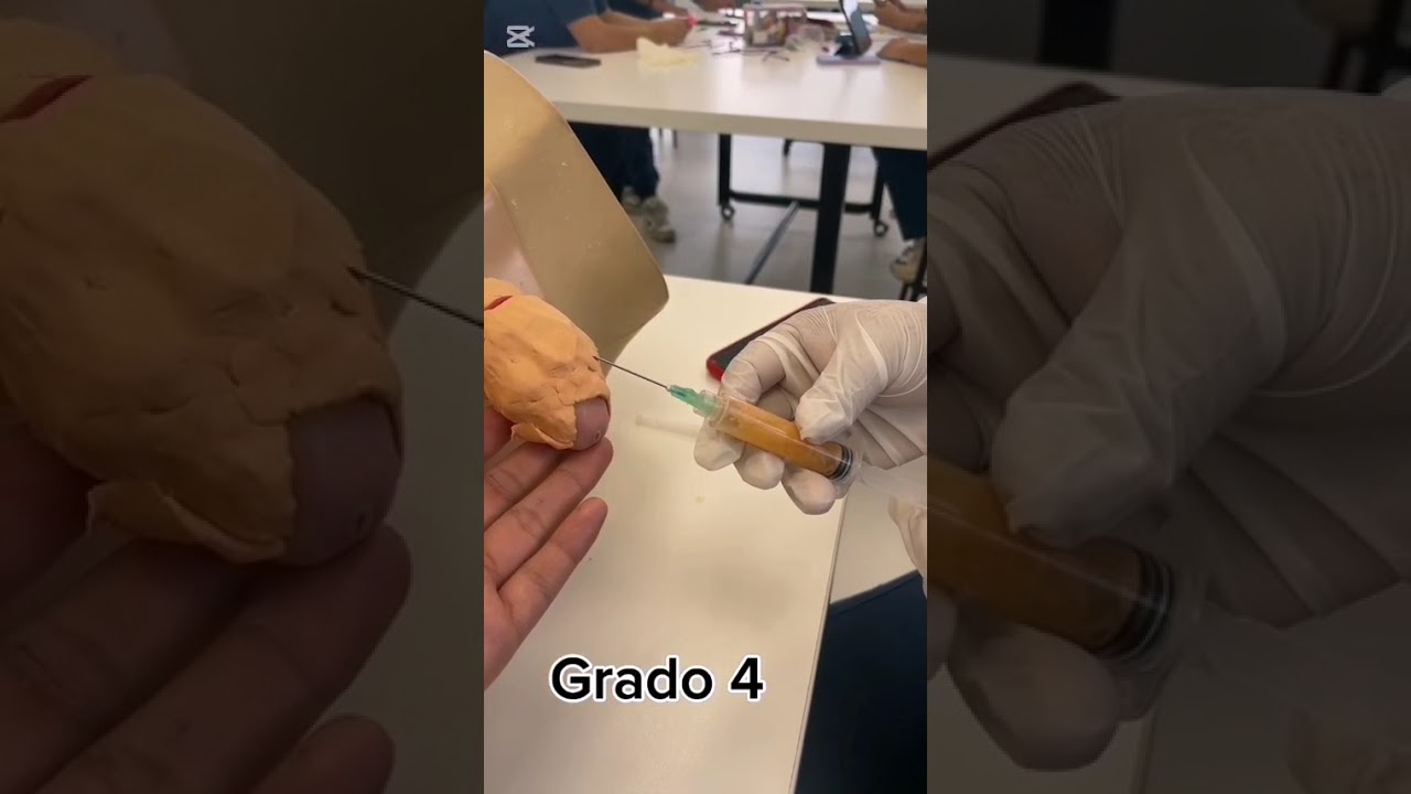 Grados Parafimosis 🩺👩‍⚕️
