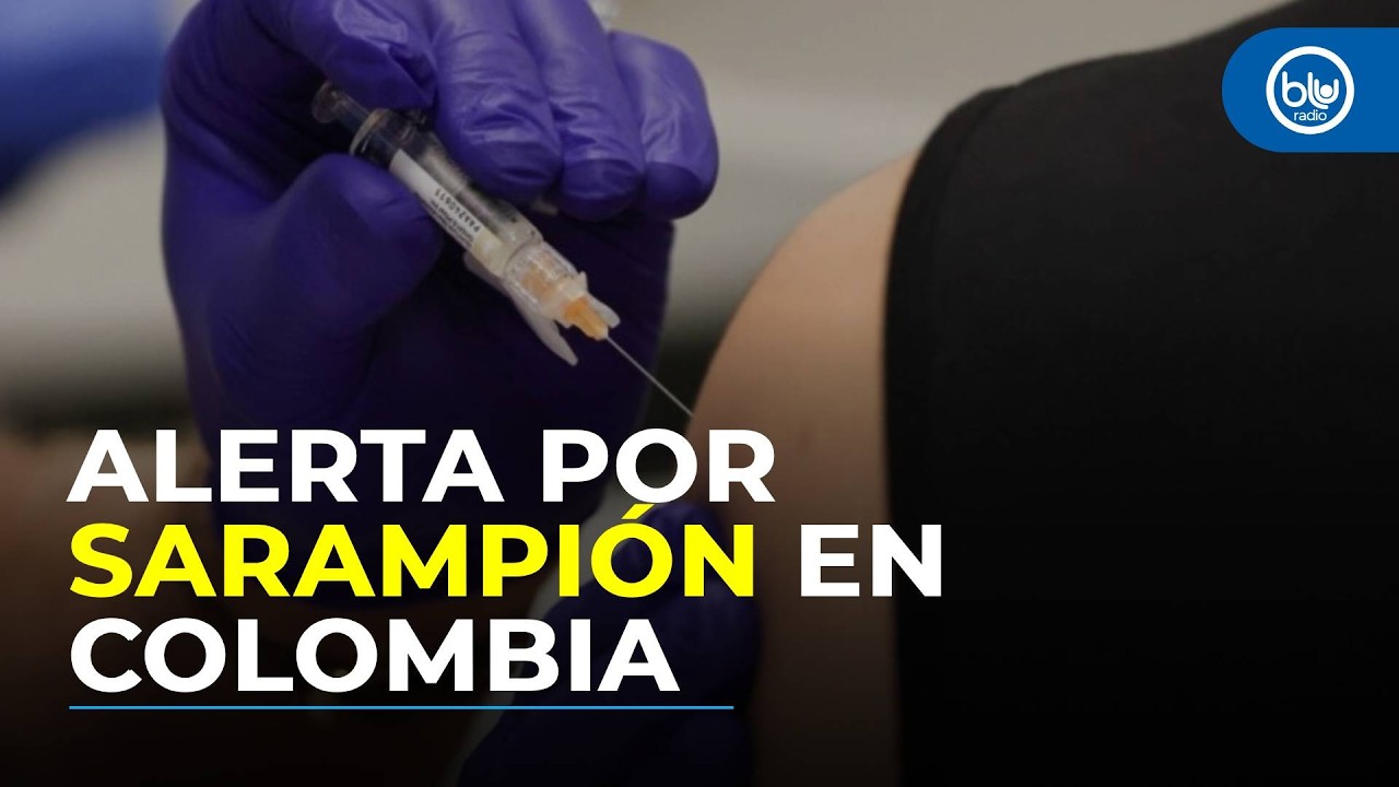 “Riesgo por sarampión en Colombia es total si no se hace nada”: secretario de Salud de Bogotá