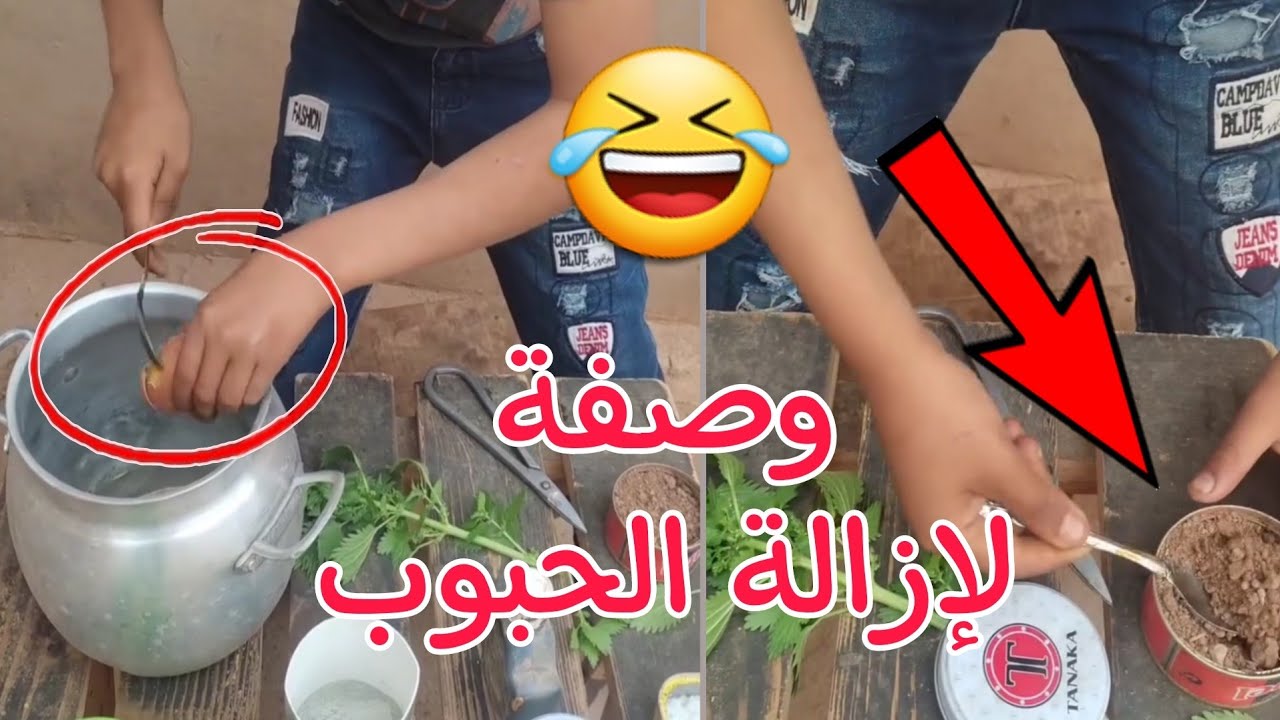 أغرب الوصفات التجميلية 🤣 وصفة لإزالة الحبوب و وصفة للغلض 🤦‍♂️😅 يالاه غير لي مابغاش 🤷‍♂️