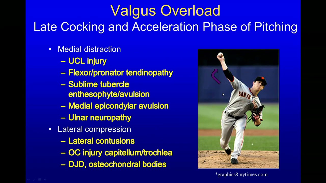 Imaging of the elbow