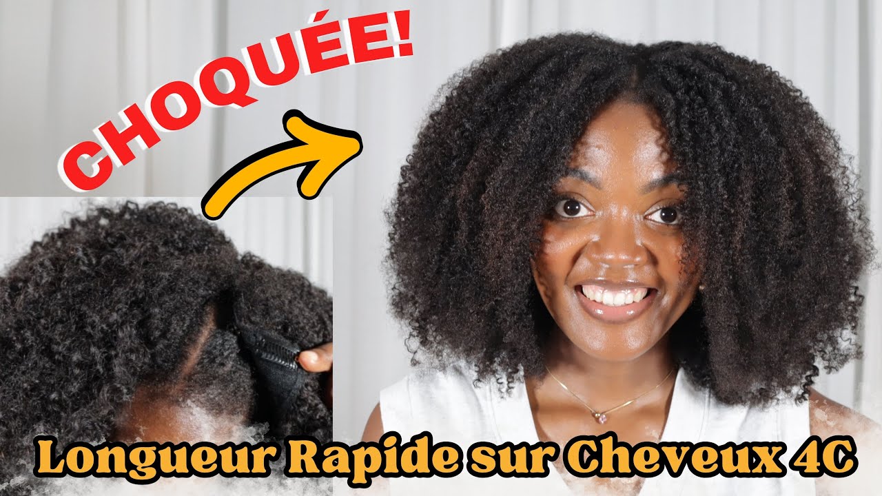 Choquée!🥹Enfin de Longs Cheveux Crépus😍 Enfin médecin👩🏾‍⚕ | BYE BYE Leave-Out Wig Hergivenhair