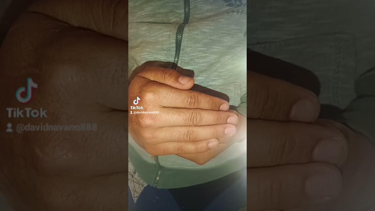 beb&eacute;s conejos con pelo de punta 😂😂😂🥰 #viral #parati #amor #viralvideo #bebe #youtubeshorts #conejo