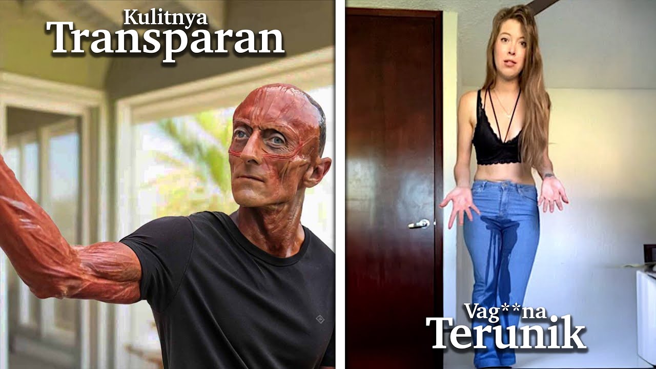 Dokter Saja Dibuat Bingung Dengan Kondisi Kesehatan Orang-Orang Paling Langka Ini 🤯😱