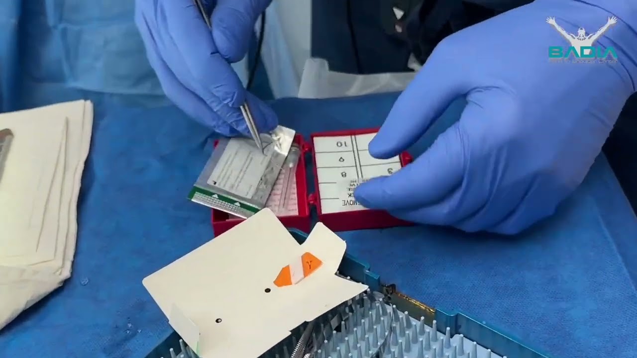 what is microsurgery ? Dr. Badia explains !