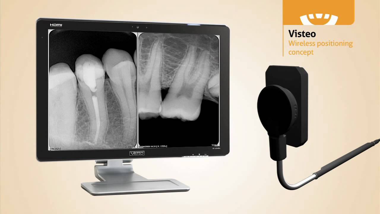 Owandy Visteo Digital Intra Oral Sensor