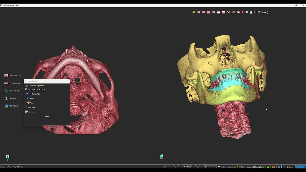 GuideMia OrthoPlus with CBCT and AlignerBot