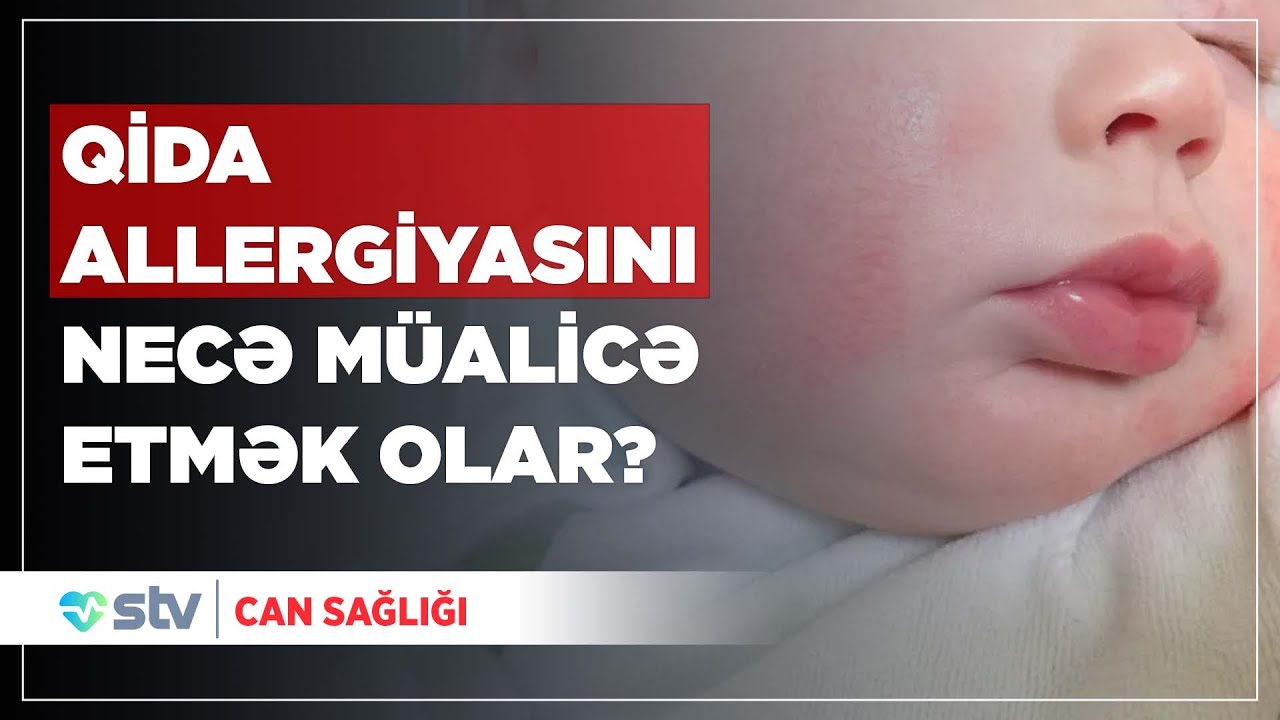 UŞAQLARDA QİDA ALLERGİYASI ƏN ÇOX NƏDƏN YARANIR? - CAN SAĞLIĞI (25.06.2024)