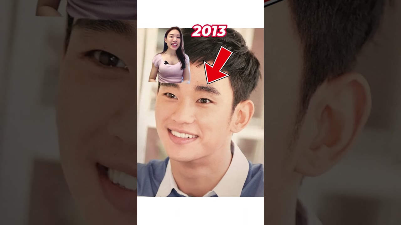 Kim Soo Hyun's Face Transformation- what did he get done? 