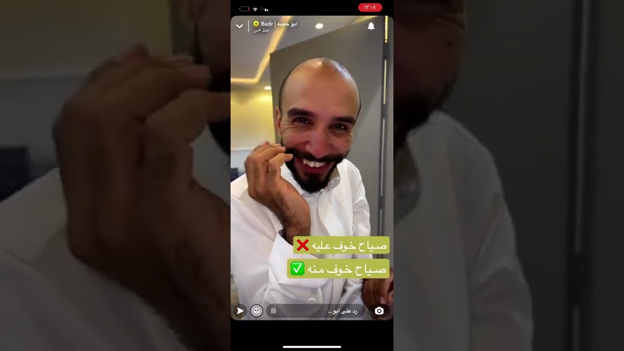 ابو عياده يسوي عمليه تكميم و ابو عجيب استغل الفرصه 😂😂/ سنابات ابو حصه