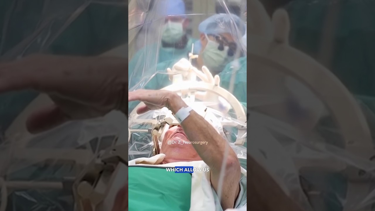 Its called deep brain stimulation (DBS)#parkinsons #parkinson #neurology #medical #doctor