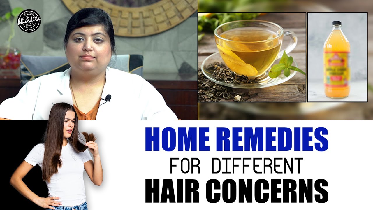 Home Remedies for Hair Fall/Hair Loss (बाल झरना कैसे रोकें और क्या है घरेलू इलाज ) | Dr. Dadu
