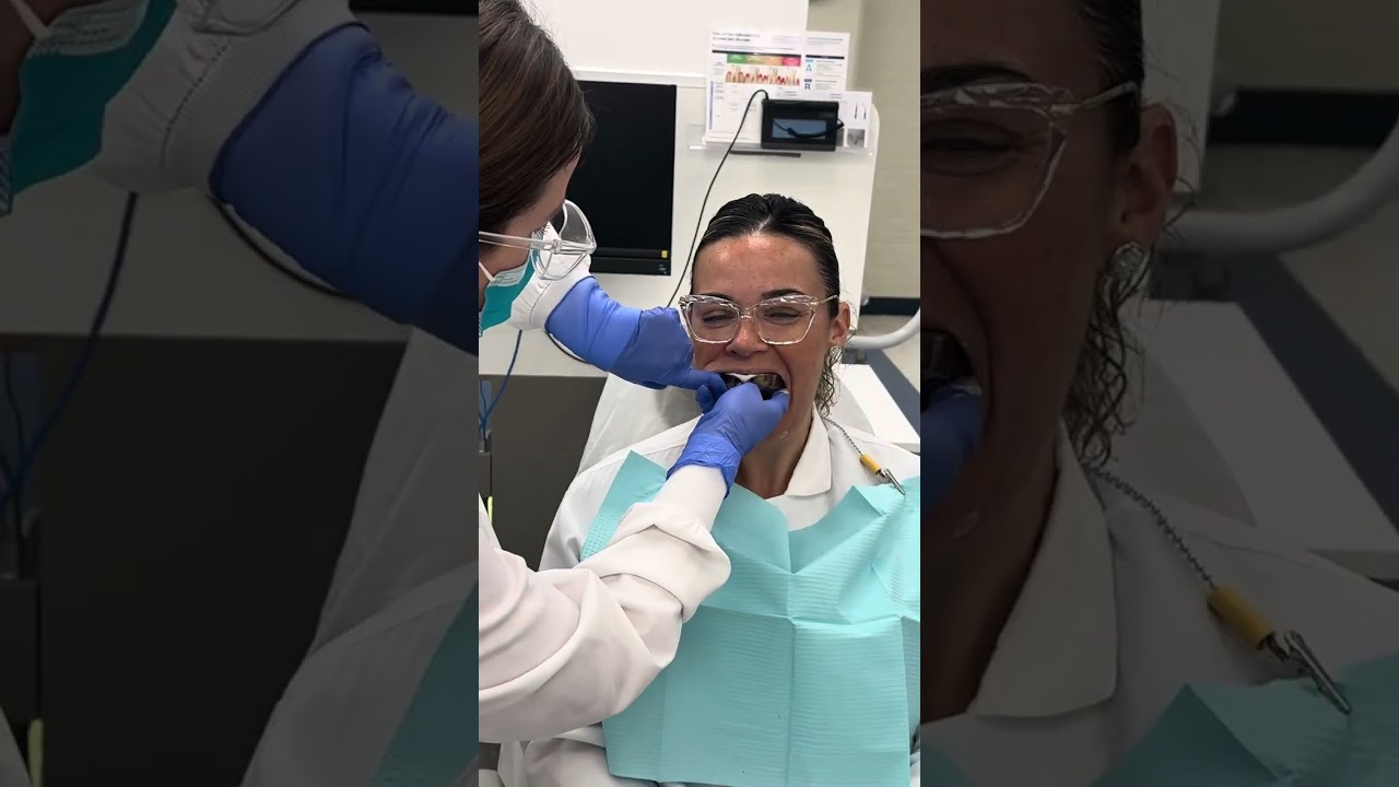 Maxillary and Mandibular Alginate Impressions 