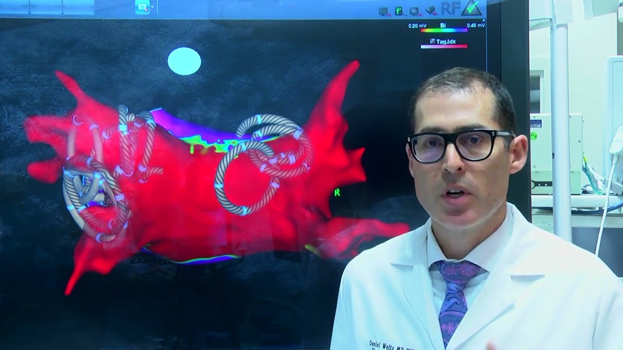 FARAPULSE&trade; Pulsed Field Ablation (PFA) System