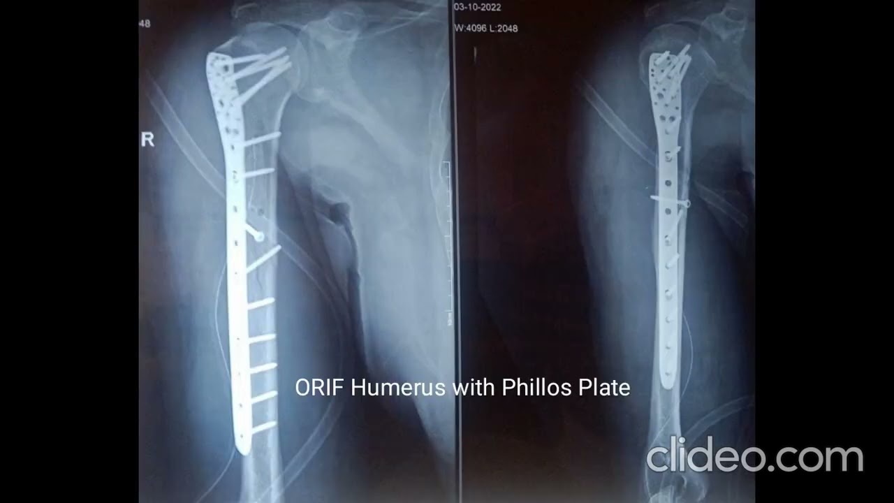 Intresting Cases Done By Me