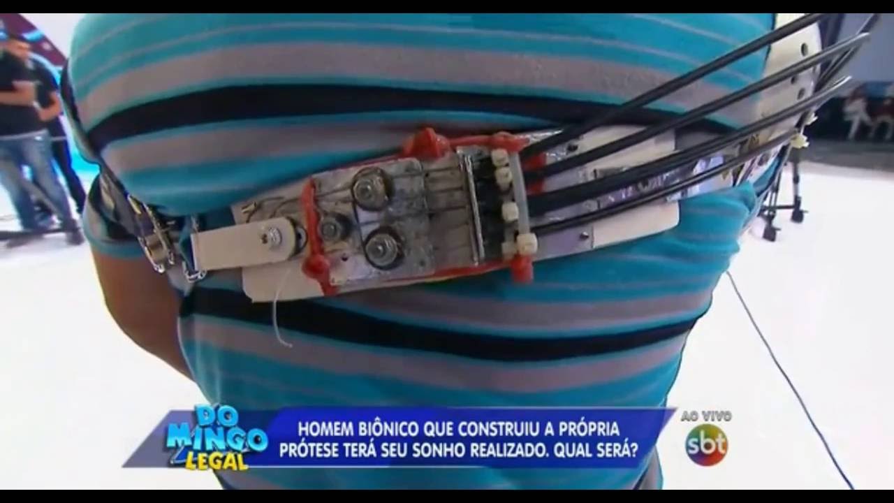 Arivelton Cria Prótese de Braço Sozinho - Homem Biônico | Conforpés