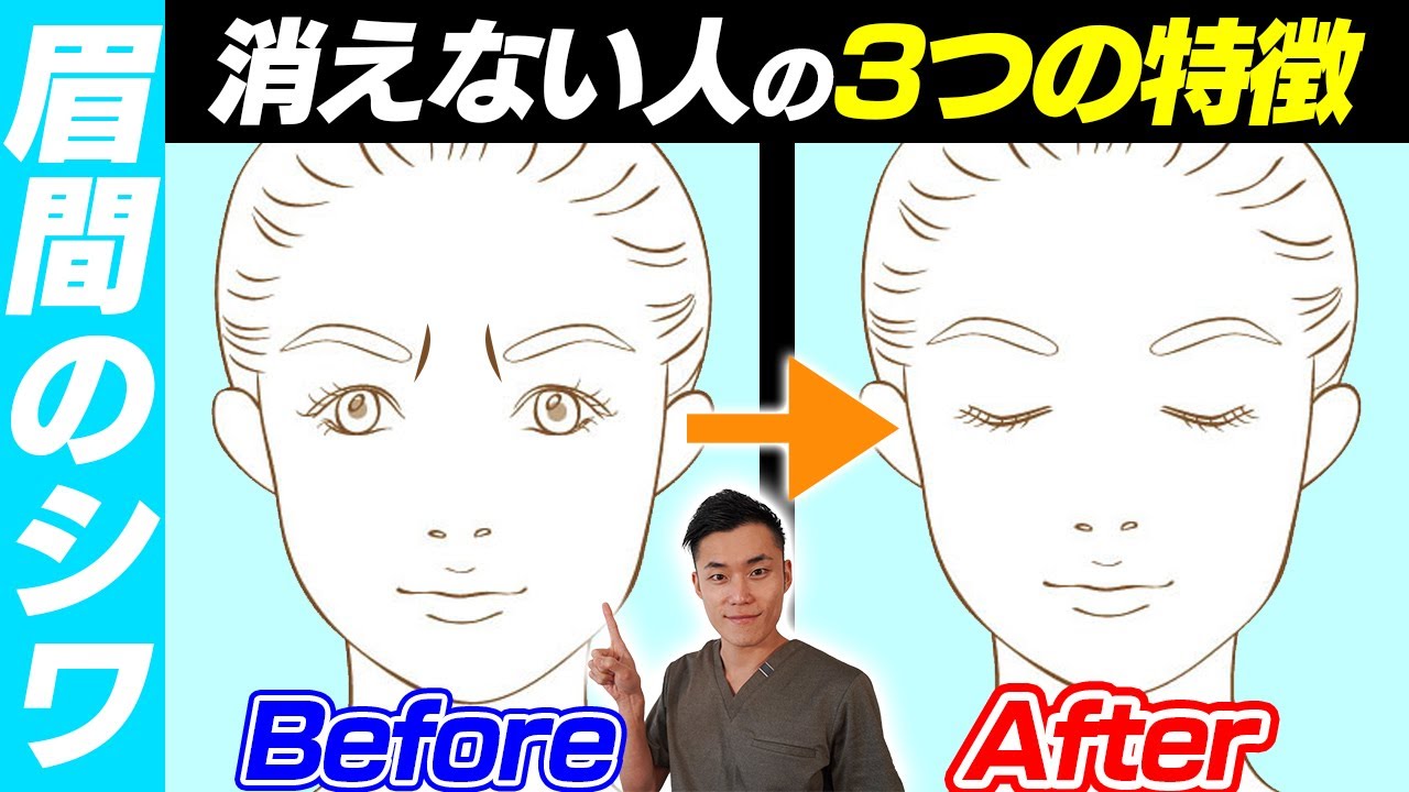 【眉間のシワ】マッサージしても消えない人3つの特徴