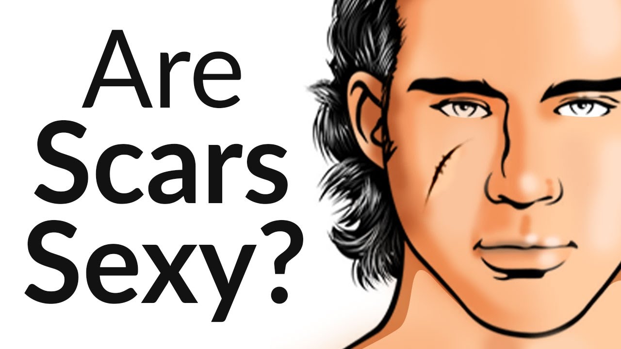 Are Facial Scars Sexy? | Do Women Find A Scar Attractive? | Acne vs Keloid vs Hypertrophic Scarring